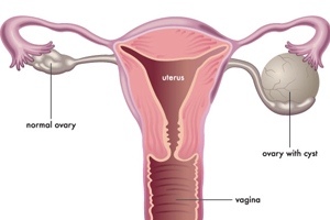 溶血是什么意思能治吗