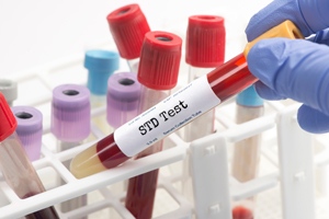 一般备孕要提前多久去做孕前检查 一般备孕要提前多久去做孕前检查